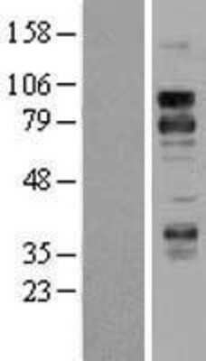 Western Blot: DR6 Overexpression Lysate (Adult Normal) [NBL1-17156] Left-Empty vector transfected control cell lysate (HEK293 cell lysate); Right -Over-expression Lysate for DR6.