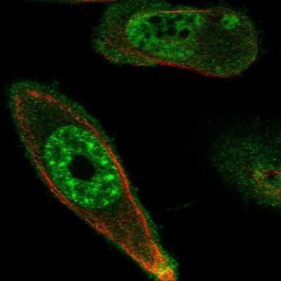 Immunocytochemistry/Immunofluorescence: DRAK1 Antibody [NBP2-55328] - Staining of human cell line PC-3 shows localization to nuclear speckles & plasma membrane.