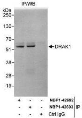 Immunoprecipitation: DRAK1 Antibody [NBP1-42692] - Whole cell lysate (1 mg for IP, 20% of IP loaded) from HeLa cells.  Antibodies: Affinity purified rabbit anti-DRAK1 antibody  used for IP at 3 mcg/mg lysate.  DRAK1 was also immunoprecipitated by rabbit anti-DRAK1 antibody NBP1-42693, which recognizes a downstream epitope.