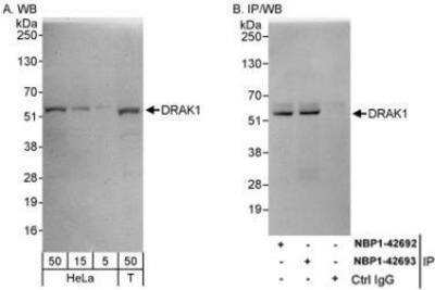 Western Blot: DRAK1 Antibody [NBP1-42693] - Whole cell lysate from HeLa (5, 15 and 50 mcg for WB; 1 mg for IP, 20% of IP loaded) and 293T (T; 50 mcg) cells.  Antibodies: Affinity purified rabbit anti-DRAK1 antibody used for WB at 0.04 mcg/ml (A) and 0.4 mcg/ml (B) and used for IP at 3 mcg/mg lysate.  DRAK1 was also immunoprecipitated by rabbit anti-DRAK1 antibody NBP1-42692, which recognizes an upstream epitope.