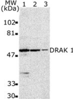 Western Blot: DRAK1 Antibody [NBP1-76896] - Analysis for DRAK1 using this antibody at 2 ug/ml dilution against 10 ug/lane of MOLT4 (lane 1), A431 (lane 2) and NIH-3T3 (lane 3) cell lysates.