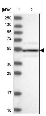 Western Blot: DRAK1 Antibody [NBP1-84981] - Lane 1: Marker  [kDa] 250, 130, 95, 72, 55, 36, 28, 17, 10.  Lane 2: Human cell line RT-4