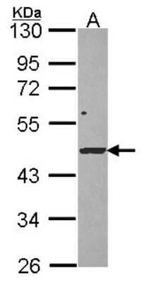 Western Blot: DRAK1 Antibody [NBP2-16224] - Sample (30 ug of whole cell lysate) A: Hela 10% SDS PAGE gel, diluted at 1:1000.