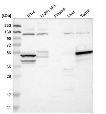 Western Blot: DRAK1 Antibody [NBP2-55328] - Western blot analysis in human cell line RT-4, human cell line U-251 MG, human plasma, human liver tissue and human tonsil tissue.