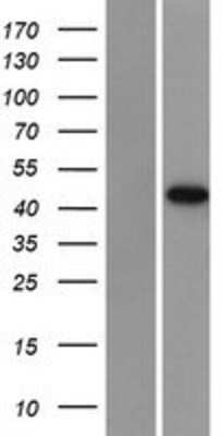 Western Blot: DRAK1 Overexpression Lysate (Adult Normal) [NBP2-10539] Left-Empty vector transfected control cell lysate (HEK293 cell lysate); Right -Over-expression Lysate for DRAK1.