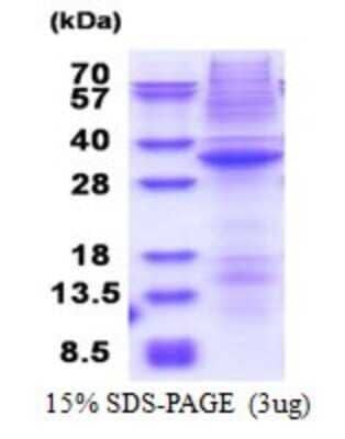 SDS-Page: DRAK1 Recombinant Protein [NBP2-51620] - 15% SDS Page (3 ug)