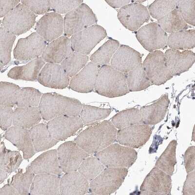 Immunohistochemistry-Paraffin: DRAK2 Antibody [NBP1-84980] - Staining of human skeletal muscle shows low expression as expected.
