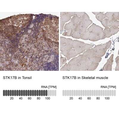 Immunohistochemistry-Paraffin DRAK2 Antibody