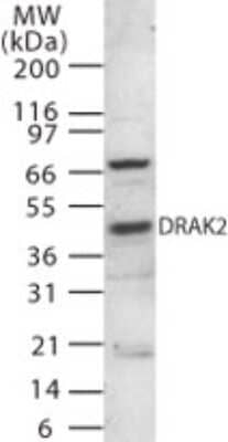 Western Blot: DRAK2 Antibody [NB100-56695] - analysis of 30 ug of total cell lysate from Raji cells with anti-DRAK2 at 3 ug/ml dilution.