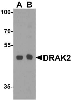 Western Blot: DRAK2 Antibody [NBP1-76885] - Analysis in Raji cell lysate with antibody at (A) 1 and B (2) ug/mL.