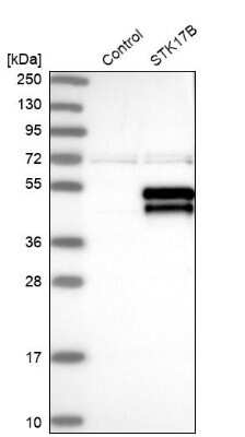 <b>Orthogonal Strategies Validation. </b>Western Blot: DRAK2 Antibody [NBP1-84980] - Analysis in control (vector only transfected HEK293T lysate) and STK17B over-expression lysate (Co-expressed with a C-terminal myc-DDK tag (3.1 kDa) in mammalian HEK293T cells).