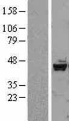 Western Blot DRAK2 Overexpression Lysate