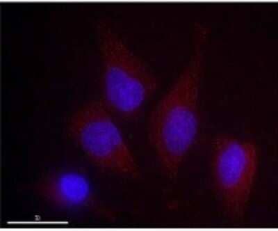 Immunocytochemistry/Immunofluorescence: DRAM Antibody (M3-P4B4) [NBP2-50379]