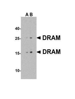 <b>Independent Antibodies Validation. </b>Western Blot: DRAM Antibody [NBP1-76759] - Western blot analysis of DRAM in 293 cell lysate with DRAM antibody at (A) 1 and (B) 2 ug/mL.