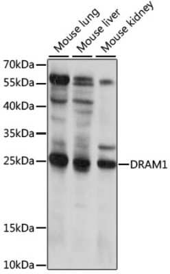 Western Blot: DRAM Antibody [NBP2-92236] - Analysis of extracts of various cell lines, using DRAM at 1:1000 dilution.Secondary antibody: HRP Goat Anti-Rabbit IgG (H+L) at 1:10000 dilution.Lysates/proteins: 25ug per lane.Blocking buffer: 3% nonfat dry milk in TBST.Detection: ECL Basic Kit .Exposure time: 15s.