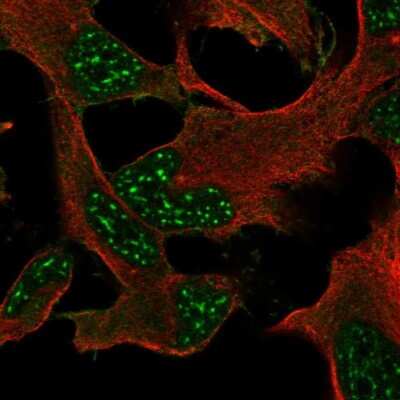 Immunocytochemistry/Immunofluorescence: DRP2 Antibody [NBP1-86525] - Staining of human cell line AF22 shows localization to nuclear speckles & plasma membrane.