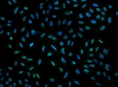 Immunocytochemistry/Immunofluorescence: DRP2 Antibody [NBP3-05842] -  Staining of DRP2 in U2OS cells. Cells were fixed with 4% PFA, permeabilzed with 0.3% Triton X-100 in PBS,blocked with 10% serum, and incubated with rabbit anti-Human DRP2 polyclonal antibody (dilution ratio 1:200) at 4? overnight. Then cells were stained with the Alexa Fluor®488-conjugated Goat Anti-rabbit IgG secondary antibody (green) and counterstained with DAPI (blue).Positive staining was localized to Nucleus.