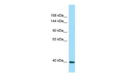 Western Blot: DRP2 Antibody [NBP2-84822] - WB Suggested Anti-DRP2 Antibody. Titration: 1.0 ug/ml. Positive Control: 721_B Whole Cell