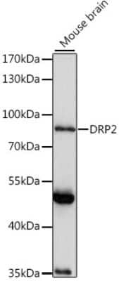 Western Blot: DRP2 Antibody [NBP2-92258] - Analysis of extracts of mouse brain, using DRP2 at 1:1000 dilution.Secondary antibody: HRP Goat Anti-Rabbit IgG (H+L) at 1:10000 dilution.Lysates/proteins: 25ug per lane.Blocking buffer: 3% nonfat dry milk in TBST.Detection: ECL Basic Kit .Exposure time: