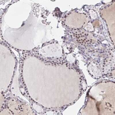 Immunohistochemistry: DSCAM-L1 Antibody [NBP2-48632] - Staining of human thyroid gland shows moderate nuclear positivity in glandular cells.