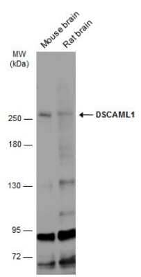 Western Blot: DSCAM-L1 Antibody [NBP3-12880] - Various tissue extracts (50 ug) were separated by 5% SDS-PAGE, and the membrane was blotted with DSCAM-L1 antibody (NBP3-12880) diluted at 1:500. The HRP-conjugated anti-rabbit IgG antibody (NBP2-19301) was used to detect the primary antibody.