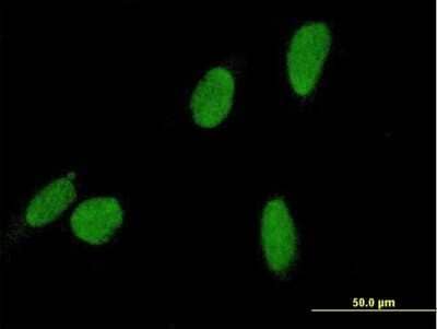 Immunocytochemistry/ Immunofluorescence DSCC1 Antibody