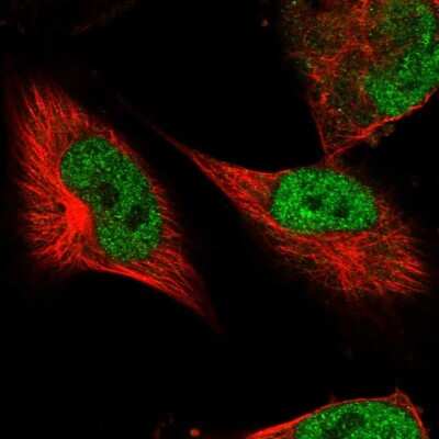 Immunocytochemistry/Immunofluorescence: DSCC1 Antibody [NBP2-58607] - Staining of human cell line U-251 MG shows localization to nucleoplasm.