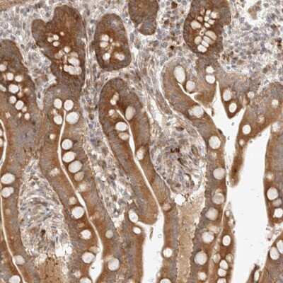 Immunohistochemistry-Paraffin: DSCC1 Antibody [NBP2-33275] - Staining of human colon shows moderate cytoplasmic positivity in glandular cells.