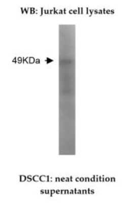 Western Blot: DSCC1 Antibody (V76P1B2-B12) [NBP2-50380] - Analysis of DSCC1 expression in Jurkat cell lysate, showing detection of a 49 kDa protein.