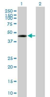 Western Blot DSCC1 Antibody