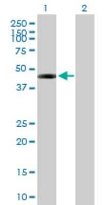 Western Blot: DSCC1 Antibody [H00079075-B01P] - Analysis of DSCC1 expression in transfected 293T cell line by DSCC1 polyclonal antibody. Lane 1: DCC1 transfected lysate (43.23 kDa). Lane 2: Non-transfected lysate.