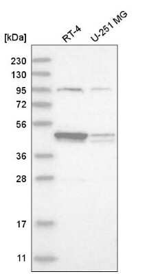 Western Blot DSCC1 Antibody - BSA Free