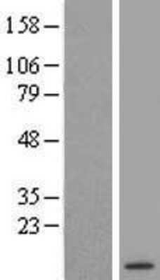 Western Blot DSCR10 Overexpression Lysate