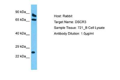 Western Blot: DSCR3 Antibody [NBP2-82928] - Host: Rabbit. Target Name: DSCR3. Sample Tissue: Human 721_B Whole Cell. Antibody Dilution: 1ug/ml