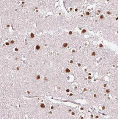 Immunohistochemistry DSCR6 Antibody - BSA Free