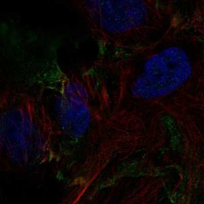 Immunocytochemistry/ Immunofluorescence DSEL Antibody