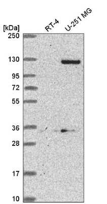 Western Blot DSEL Antibody