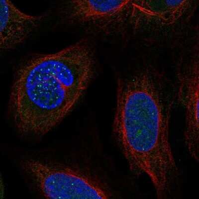Immunocytochemistry/ Immunofluorescence DSN1 Antibody - BSA Free