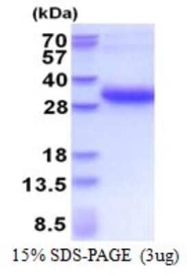 SDS-PAGE Recombinant Human DSU His Protein