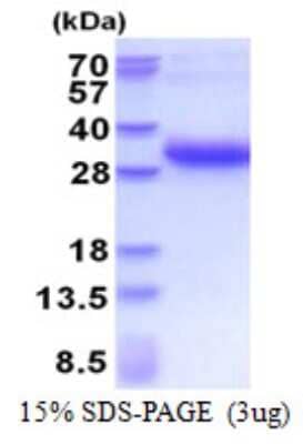 SDS-PAGE Recombinant Human DSU His Protein