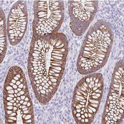 Immunohistochemistry DTW Domain Containing 2 Antibody - BSA Free