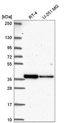 Western Blot DTW Domain Containing 2 Antibody - BSA Free