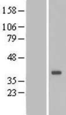 Western Blot: DTWD1 Overexpression Lysate (Adult Normal) [NBP2-06670] Left-Empty vector transfected control cell lysate (HEK293 cell lysate); Right -Over-expression Lysate for DTWD1.