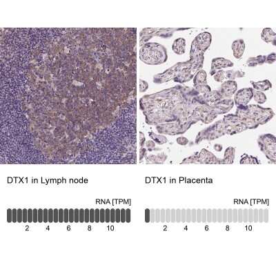 Immunohistochemistry-Paraffin: DTX1 Antibody [NBP2-58472] - Analysis in human lymph node and placenta tissues using NBP2-58472 antibody. Corresponding DTX1 RNA-seq data are presented for the same tissues.