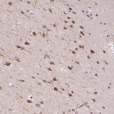 Immunohistochemistry-Paraffin: DTX1 Antibody [NBP2-58472] - Staining of human Cerebral cortex shows moderate nuclear and cytoplasmic positivity in neuronal cells.