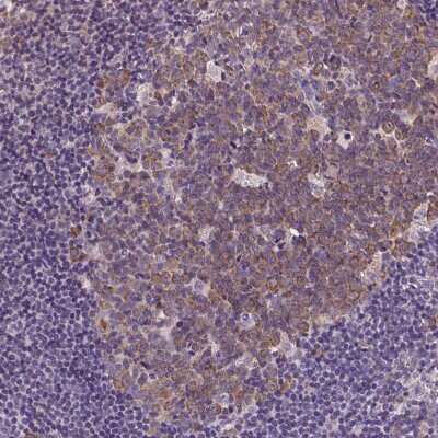 Immunohistochemistry-Paraffin: DTX1 Antibody [NBP2-58472] - Staining of human Lymph node shows moderate cytoplasmic positivity in germinal center cells.