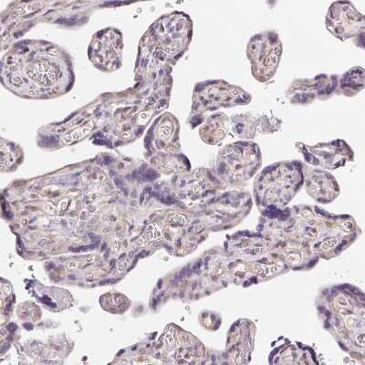 Immunohistochemistry-Paraffin: DTX1 Antibody [NBP2-58472] - Staining of human Placenta shows no positivity in trophoblastic cells as expected.