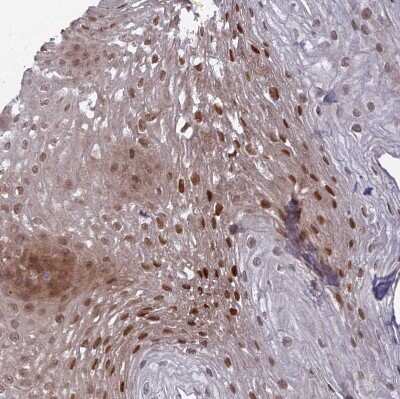Immunohistochemistry-Paraffin: DTX2 Antibody [NBP2-13941] - Staining of human Esophagus shows moderate nuclear positivity in squamous epithelial cells.