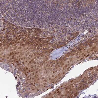 Immunohistochemistry-Paraffin: DTX2 Antibody [NBP2-13941] - Staining of human Tonsil shows moderate nuclear and cytoplasmic positivity in squamous epithelial cells.
