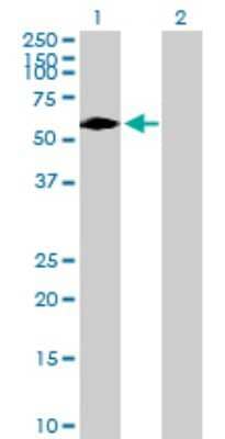 Western Blot: DTX2 Antibody [H00113878-B01P] - Analysis of DTX2 expression in transfected 293T cell line by DTX2 polyclonal antibody.  Lane 1: DTX2 transfected lysate(68.42 KDa). Lane 2: Non-transfected lysate.